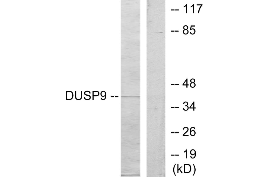 Western Blot - Anti-DUSP9 Antibody (C11586) - Antibodies.com