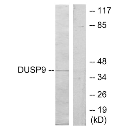 Western Blot - Anti-DUSP9 Antibody (C11586) - Antibodies.com