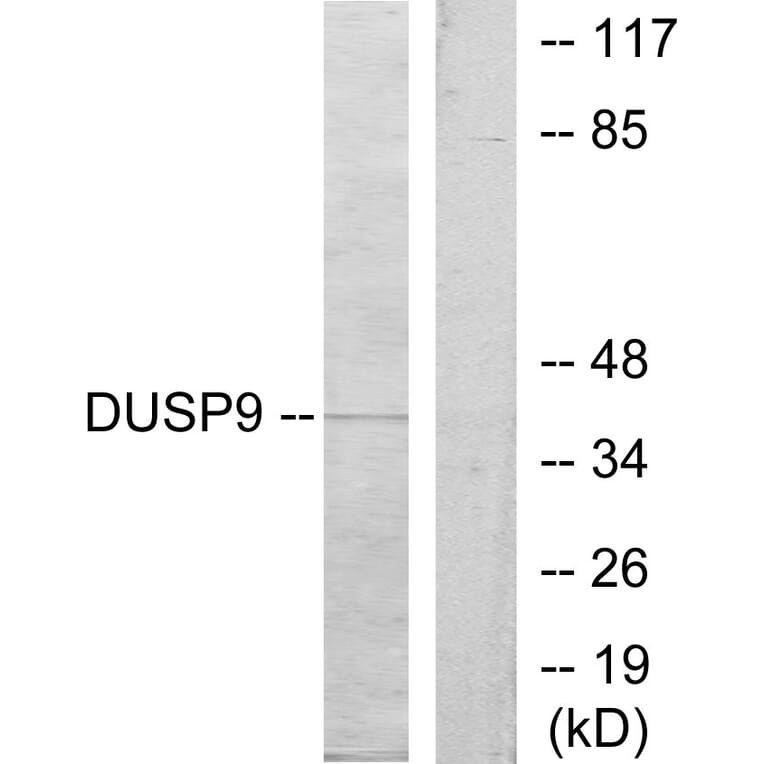 Western Blot - Anti-DUSP9 Antibody (C11586) - Antibodies.com