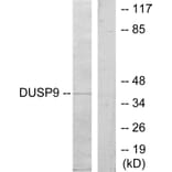 Western Blot - Anti-DUSP9 Antibody (C11586) - Antibodies.com