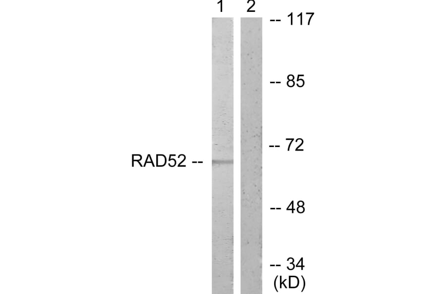 Western Blot - Anti-DRP-2 Antibody (B1199) - Antibodies.com