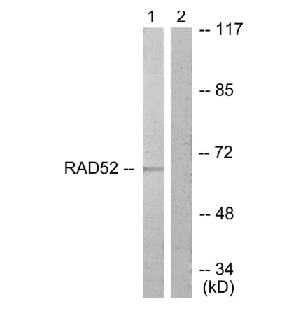 Western Blot - Anti-DRP-2 Antibody (B1199) - Antibodies.com
