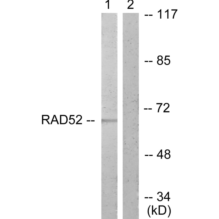 Western Blot - Anti-DRP-2 Antibody (B1199) - Antibodies.com