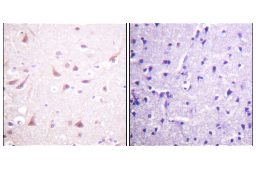 Immunohistochemistry - Anti-DRP-2 Antibody (B1199) - Antibodies.com
