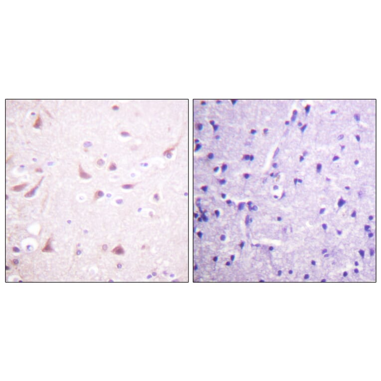 Immunohistochemistry - Anti-DRP-2 Antibody (B1199) - Antibodies.com