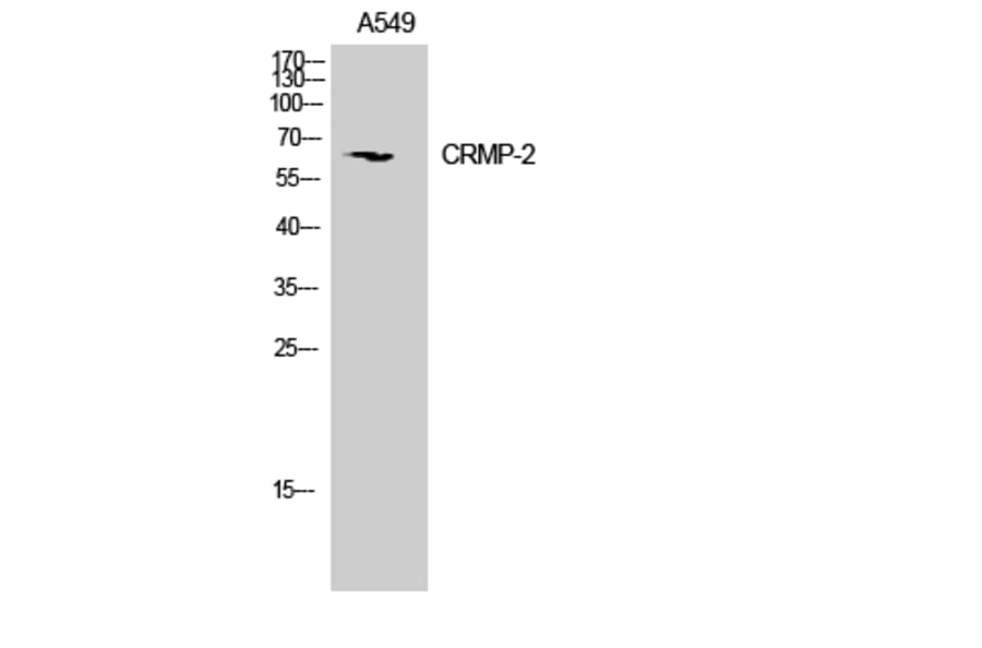 Western Blot - Anti-DRP-2 Antibody (B1199) - Antibodies.com