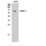 Western Blot - Anti-DRP-2 Antibody (B1199) - Antibodies.com