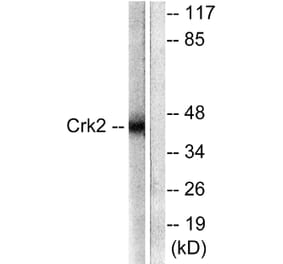 Western Blot - Anti-CrkII Antibody (B0066) - Antibodies.com