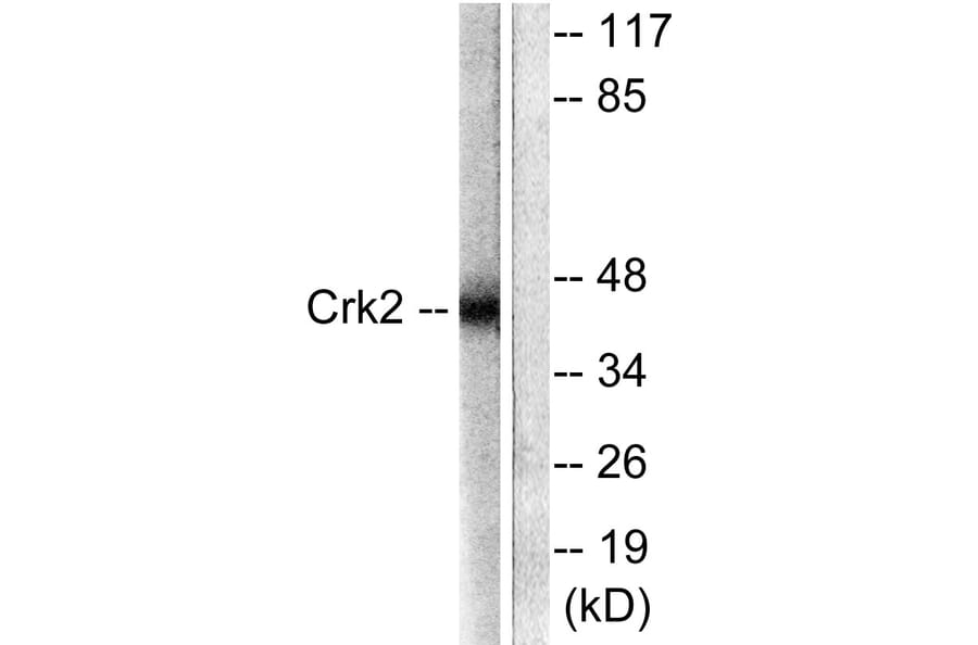 Western Blot - Anti-CrkII Antibody (B0066) - Antibodies.com