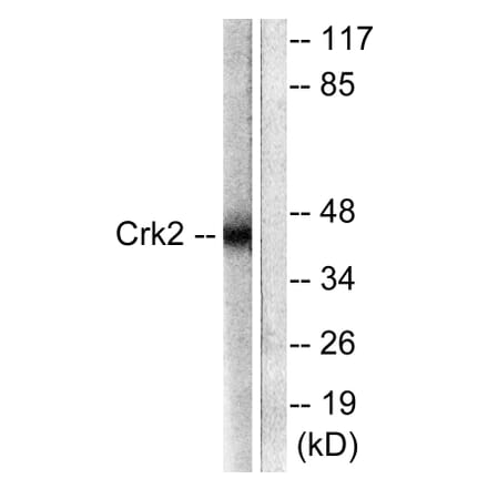 Western Blot - Anti-CrkII Antibody (B0066) - Antibodies.com