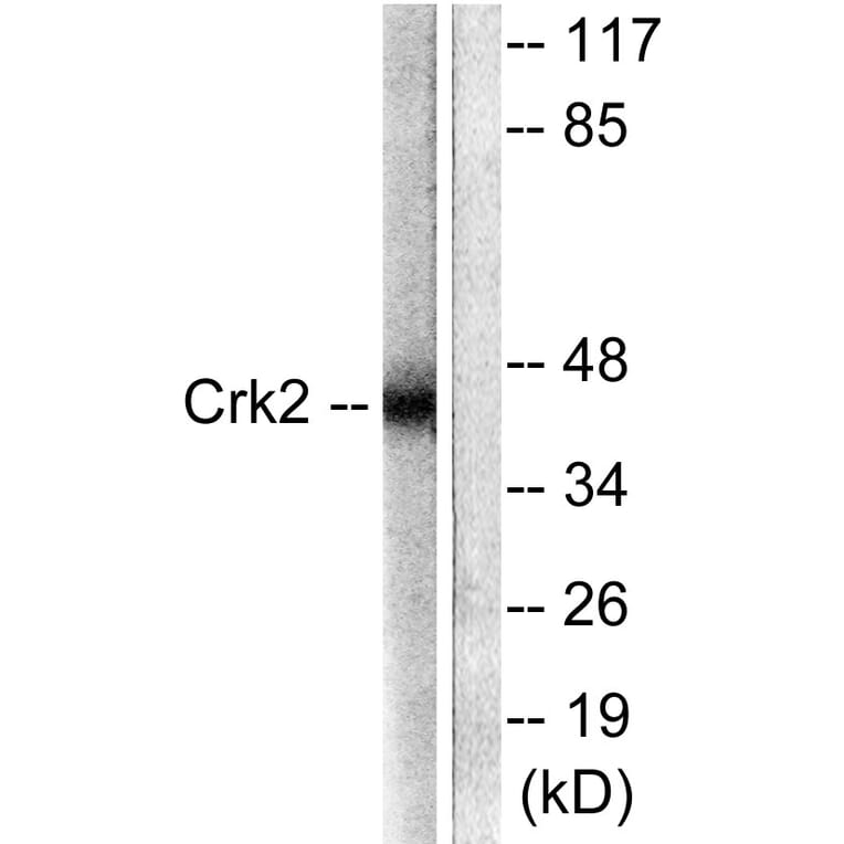 Western Blot - Anti-CrkII Antibody (B0066) - Antibodies.com