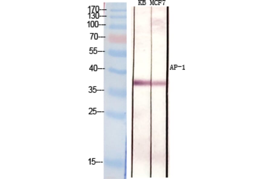 Immunohistochemistry - Anti-c-Jun Antibody (B7132) - Antibodies.com