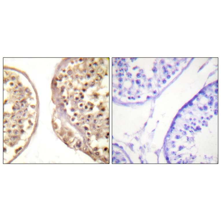 Immunohistochemistry - Anti-c-Jun Antibody (B0867) - Antibodies.com