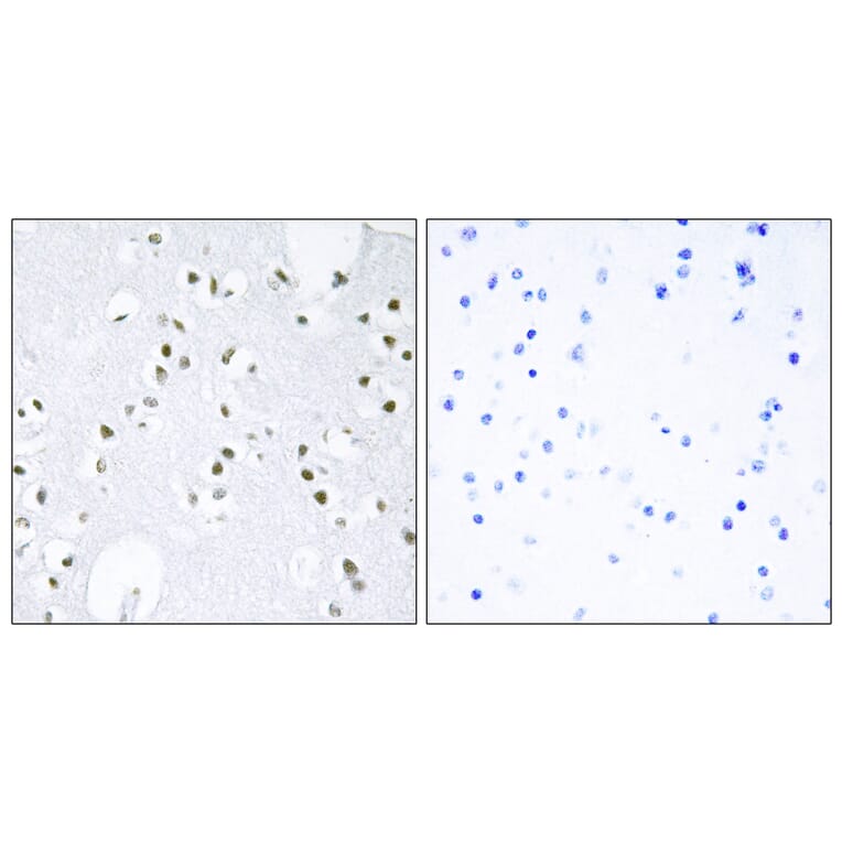 Immunohistochemistry - Anti-c-Jun Antibody (B7130) - Antibodies.com