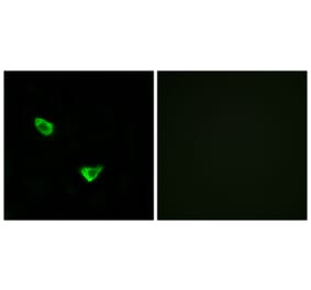 Immunofluorescence - Anti-CHSY2 Antibody (C15099) - Antibodies.com