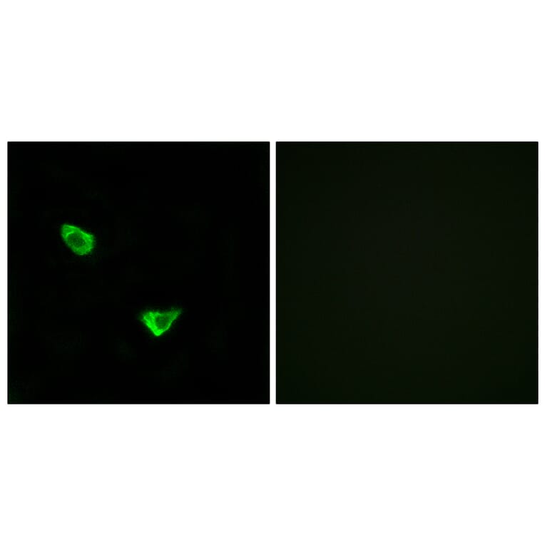 Immunofluorescence - Anti-CHSY2 Antibody (C15099) - Antibodies.com