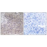 Immunohistochemistry - Anti-CHSY2 Antibody (C15099) - Antibodies.com