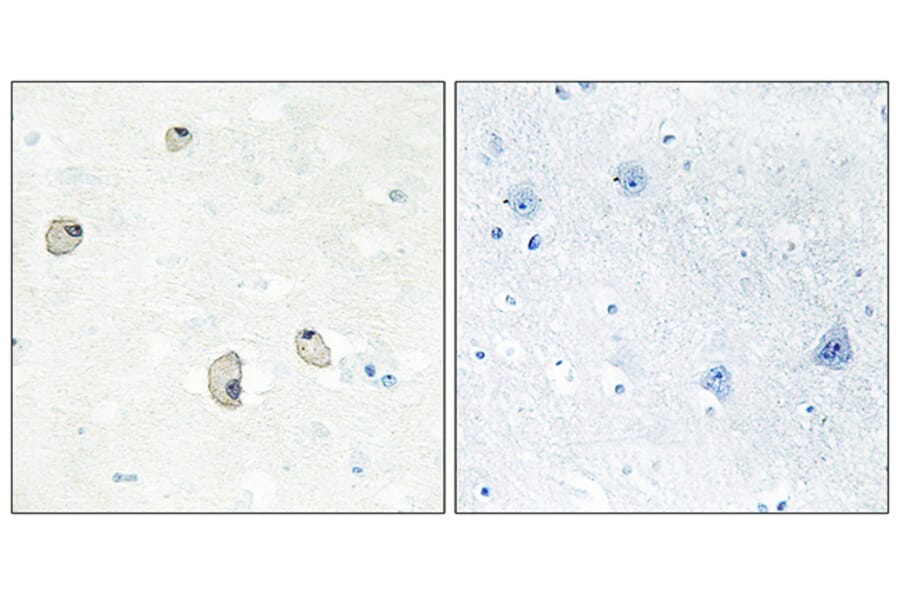 Immunohistochemistry - Anti-CDH22 Antibody (C12096) - Antibodies.com