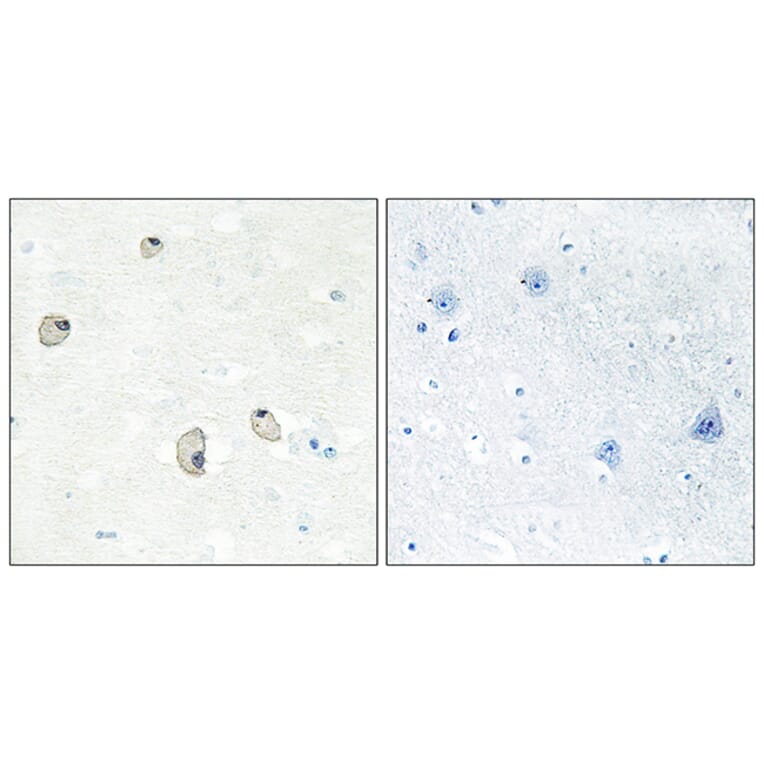 Immunohistochemistry - Anti-CDH22 Antibody (C12096) - Antibodies.com