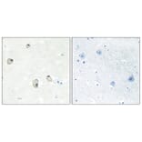 Immunohistochemistry - Anti-CDH22 Antibody (C12096) - Antibodies.com