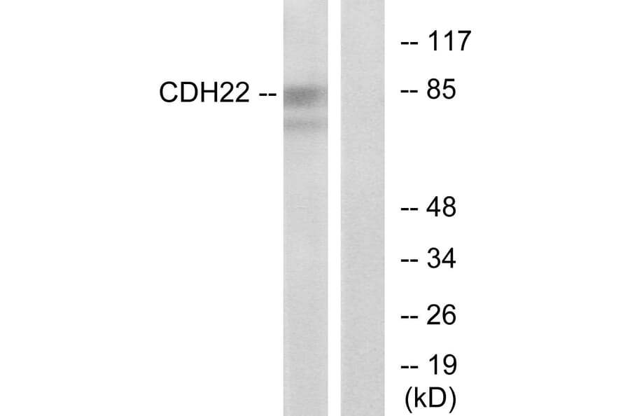 Western Blot - Anti-CDH22 Antibody (C12096) - Antibodies.com