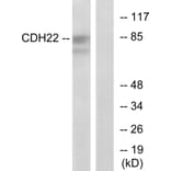 Western Blot - Anti-CDH22 Antibody (C12096) - Antibodies.com