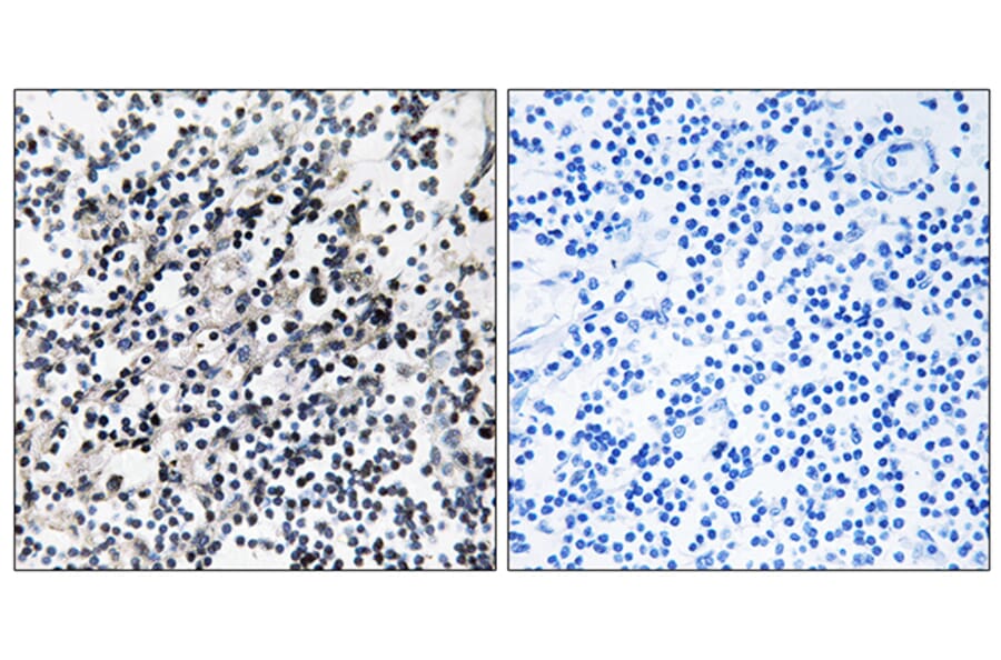 Immunohistochemistry - Anti-CDC37 Antibody (B1048) - Antibodies.com