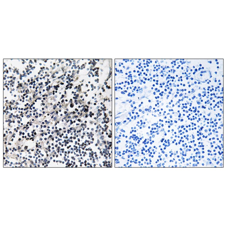 Immunohistochemistry - Anti-CDC37 Antibody (B1048) - Antibodies.com