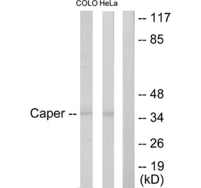 Western Blot - Anti-Caper Antibody (C10192) - Antibodies.com
