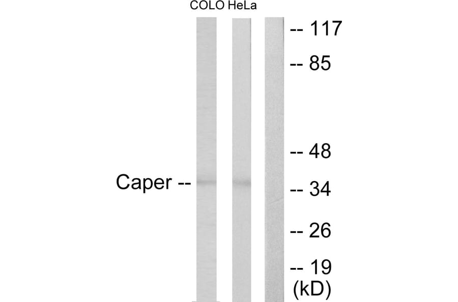Western Blot - Anti-Caper Antibody (C10192) - Antibodies.com