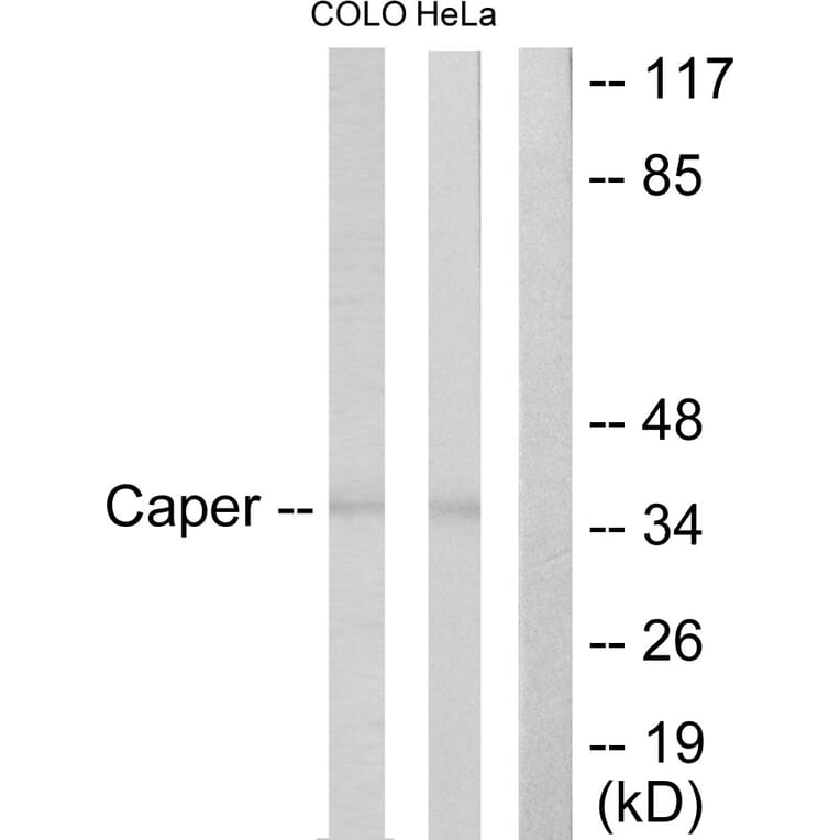 Western Blot - Anti-Caper Antibody (C10192) - Antibodies.com