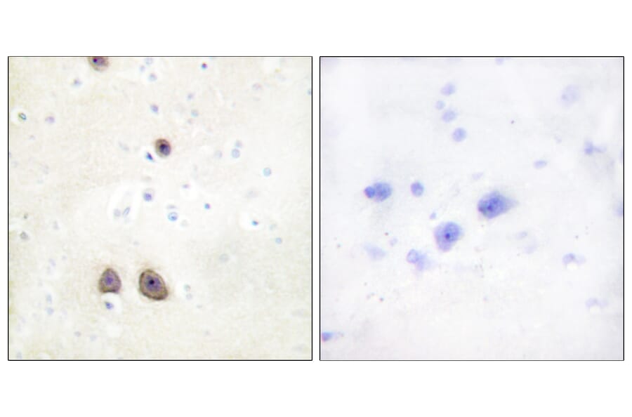 Immunohistochemistry - Anti-Caper Antibody (C10192) - Antibodies.com
