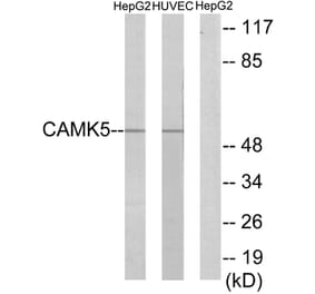 Western Blot - Anti-CAMK5 Antibody (C11363) - Antibodies.com