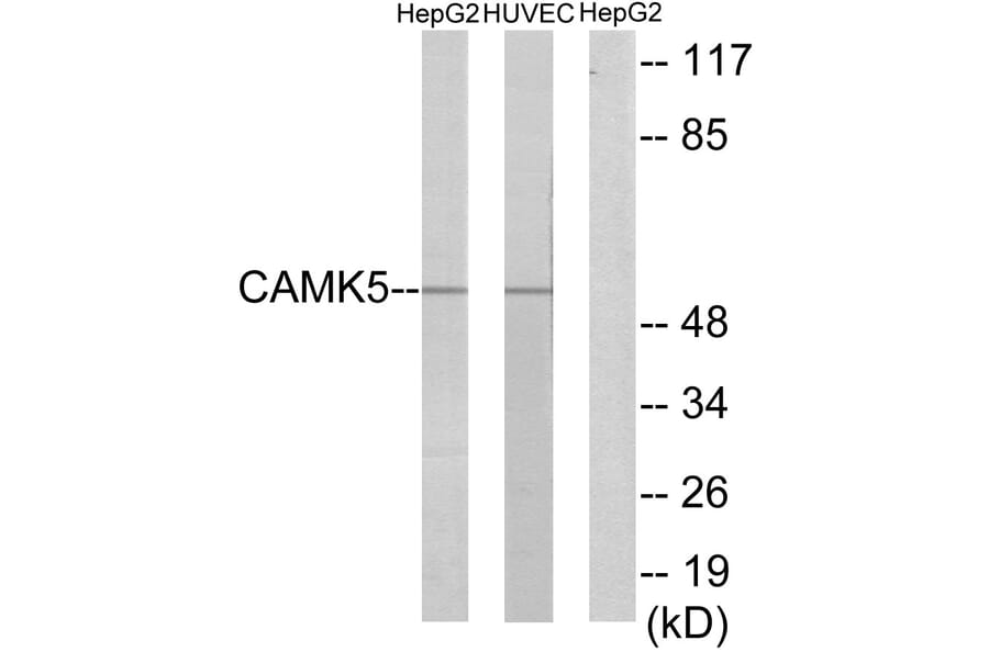 Western Blot - Anti-CAMK5 Antibody (C11363) - Antibodies.com