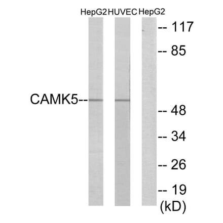 Western Blot - Anti-CAMK5 Antibody (C11363) - Antibodies.com