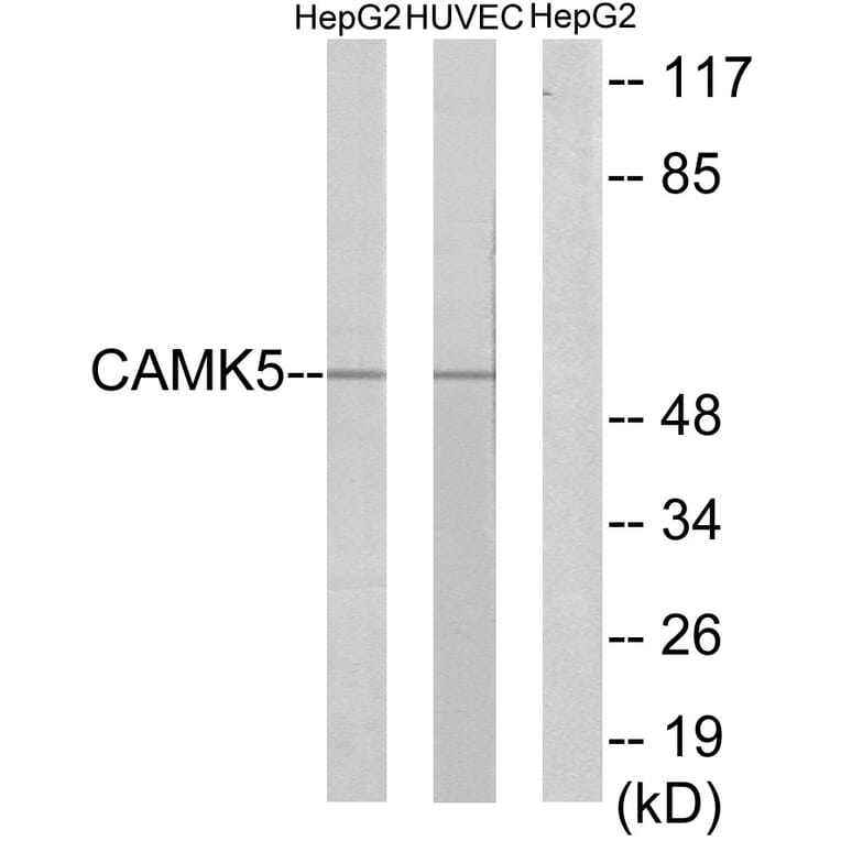 Western Blot - Anti-CAMK5 Antibody (C11363) - Antibodies.com