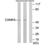 Western Blot - Anti-CAMK5 Antibody (C11363) - Antibodies.com