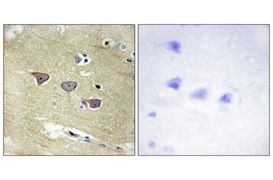 Immunohistochemistry - Anti-CAMK5 Antibody (C11363) - Antibodies.com