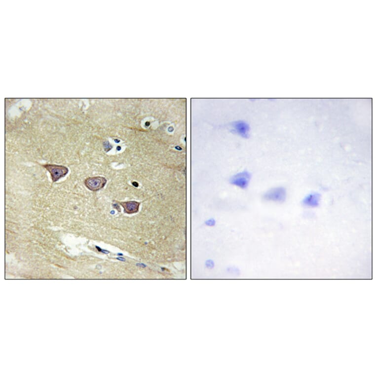 Immunohistochemistry - Anti-CAMK5 Antibody (C11363) - Antibodies.com