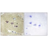 Immunohistochemistry - Anti-CAMK5 Antibody (C11363) - Antibodies.com