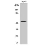 Western Blot - Anti-CAMK5 Antibody (C11363) - Antibodies.com