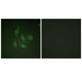 Immunofluorescence - Anti-CaMK4 Antibody (B0831) - Antibodies.com
