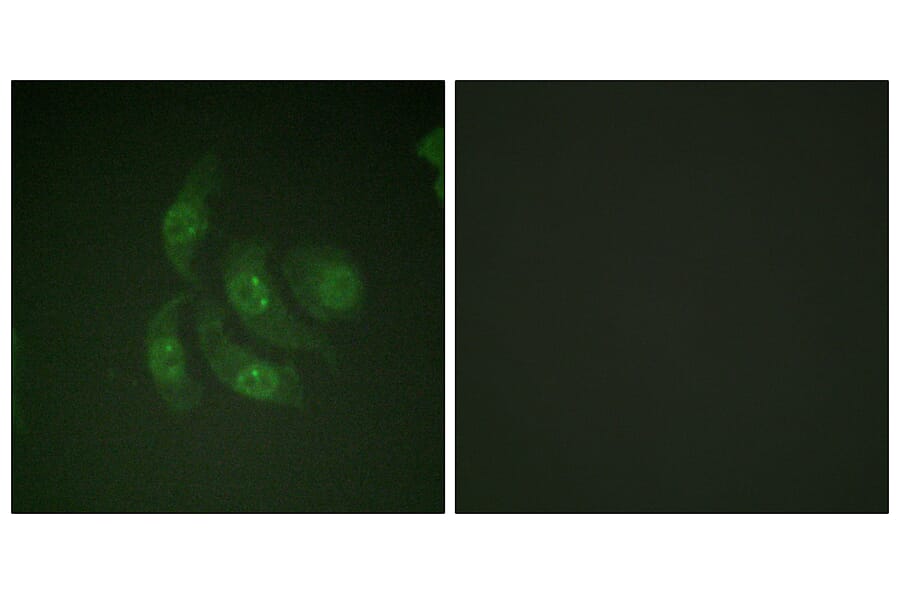 Immunofluorescence - Anti-CaMK4 Antibody (B0831) - Antibodies.com