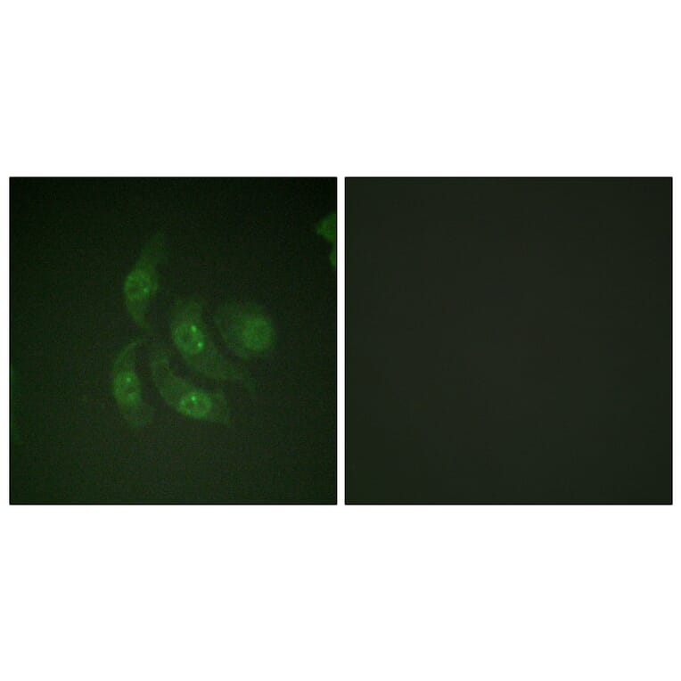 Immunofluorescence - Anti-CaMK4 Antibody (B0831) - Antibodies.com