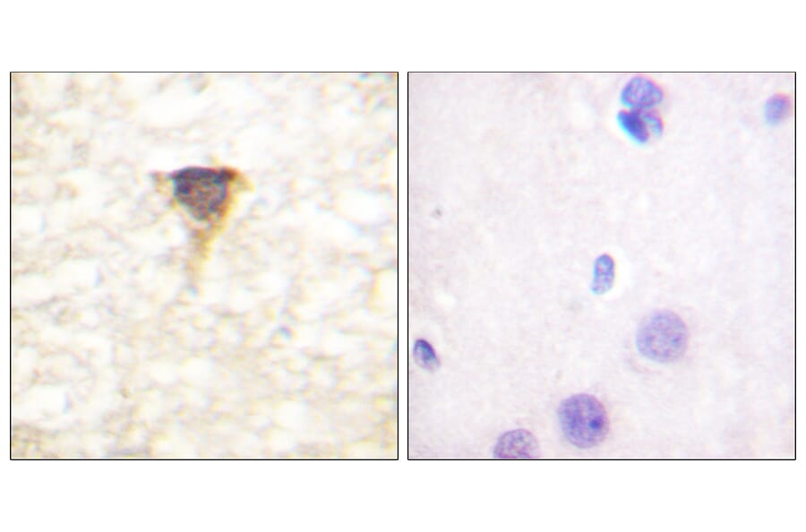 Immunohistochemistry - Anti-CaMK4 Antibody (B0831) - Antibodies.com