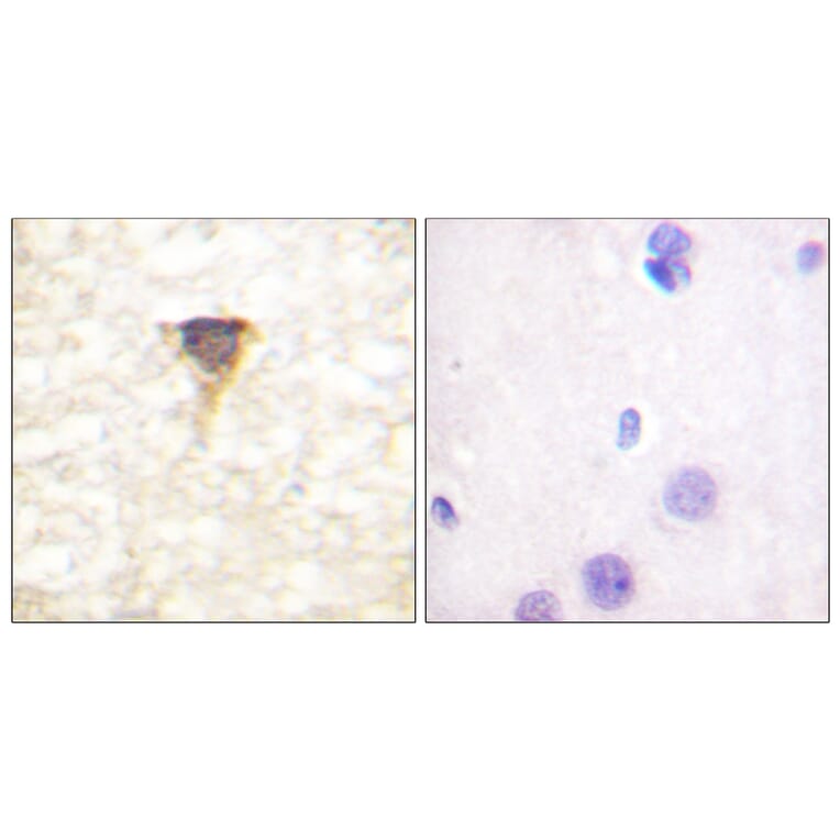 Immunohistochemistry - Anti-CaMK4 Antibody (B0831) - Antibodies.com