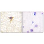 Immunohistochemistry - Anti-CaMK4 Antibody (B0831) - Antibodies.com