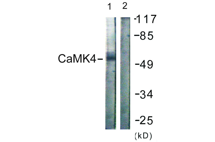 Western Blot - Anti-CaMK4 Antibody (B0831) - Antibodies.com