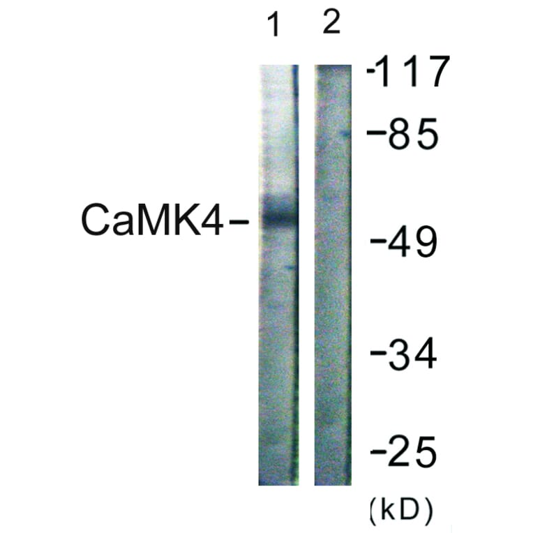 Western Blot - Anti-CaMK4 Antibody (B0831) - Antibodies.com