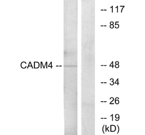 Western Blot - Anti-CADM4 Antibody (C12111) - Antibodies.com